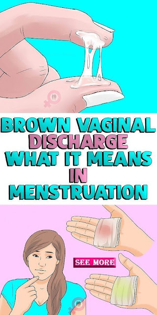 What Causes Brown Discharge Before a Period?