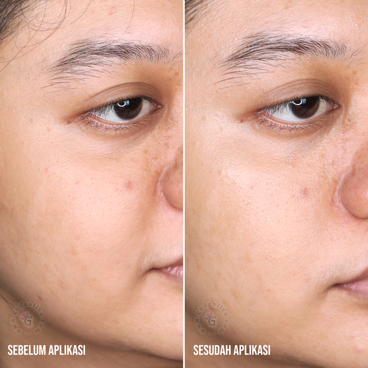 Before after base personalized skincare