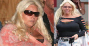 Did Beth Chapman have Plastic Surgery Before and After Photos