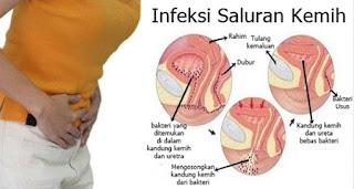 PENYEBAB SERTA GEJALA UMUM INFEKSI SALURAN KEMIH