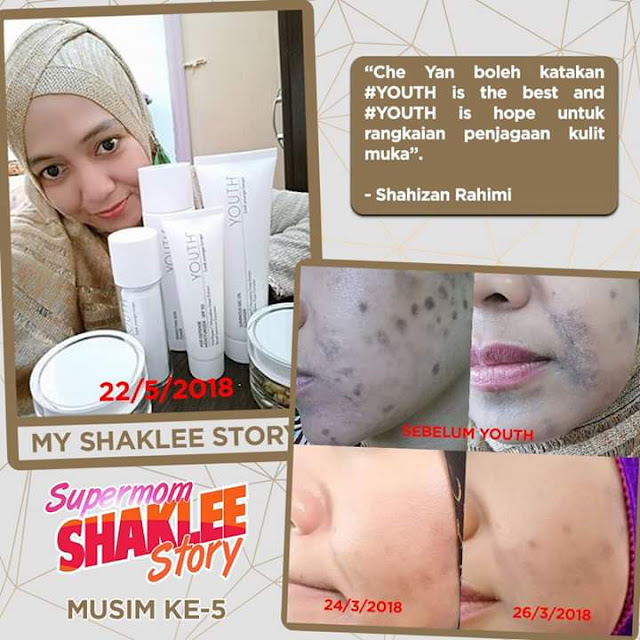 Wajah rosak ,kukit wajah rosak kerana salah pilih skincare, cara atasi kulit wajah rosak, cara rawat kulit wajah rosak, set wajah untuk kulit rosak, set.skincare yang bagus untuk kulit rosak, pengedar shaklee perlis, penjual shaklee perlis, pengedar shaklee kangar,cod vitamin shaklee, cod vitamin shaklee kangar, cod vitamin shaklee arau, cod vitamin shaklee padang besar.