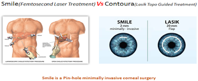 Smile vs Contoura which is better/best?