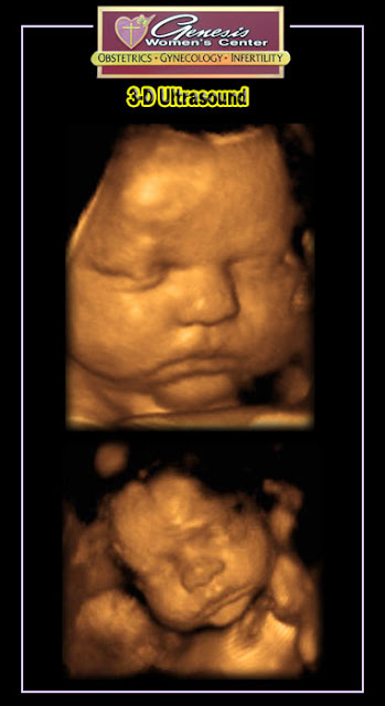 3d Ultrasounds5