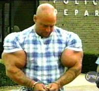 the man whose arms exploded