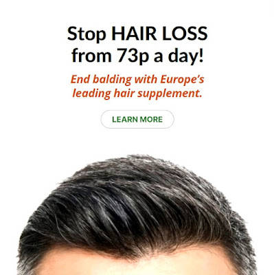 best hair loss treatment for men