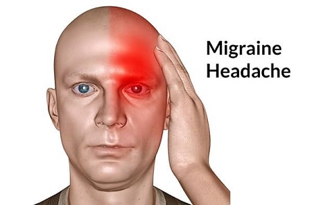 What is Excedrin Migraine?