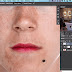 How to Remove Acne in Photoshop