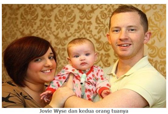 Jovie Wyse, Berjuang Mengatasi Penyakit Berhenti Bernafas  Setiap Kali Tidur