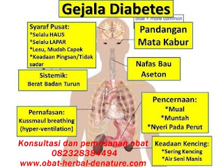 obat diabetes militus,obat herbal diabetes,obat diabetes herbal,cara mengobati diabetes secara herbal,pengobatan diabetes secara herbal,pengobatan diabetes tanpa resep dokter