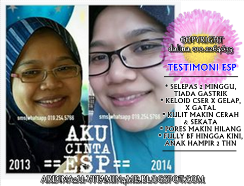 Testimoni ESP, Gastrik, Kulit Cerah, Kulit Sekata, Keloid Cser, Pores, Menyusu