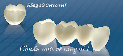 răng toàn sứ Cercon