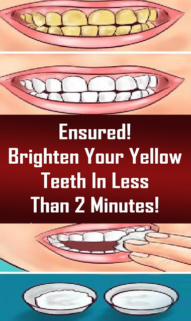 Ensured! Brighten Your Yellow Teeth In Less Than 2 Minutes!