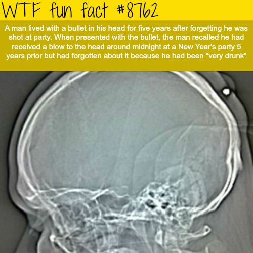 Amazing Weird And Interesting Random Facts