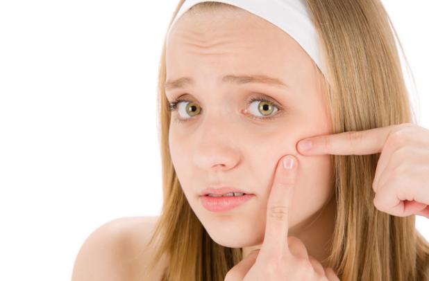 Tips To Avoid Of Acne