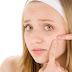 Tips To Avoid Of Acne