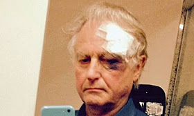 Dawkins, wounded