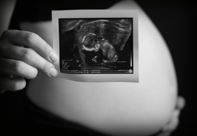 Fotos de grávidas com ultrassom