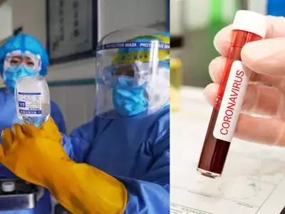 Treatment Of Corona Virus By Plasma Therapy