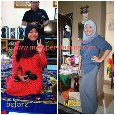 Testimoni Set Slimming Shaklee