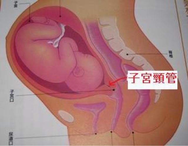 クルトンの育児とその弱音雑記帳 子宮筋腫の変性痛 クルトンの育児とその弱音雑記帳 子宮筋腫の変性痛