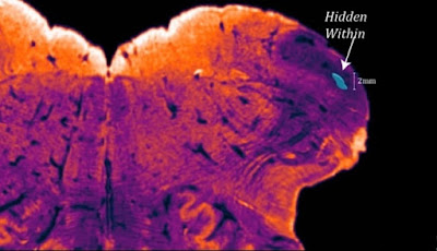 Wilayah Tersembunyi Otak Manusia Ditemukan, Apa Fungsinya?