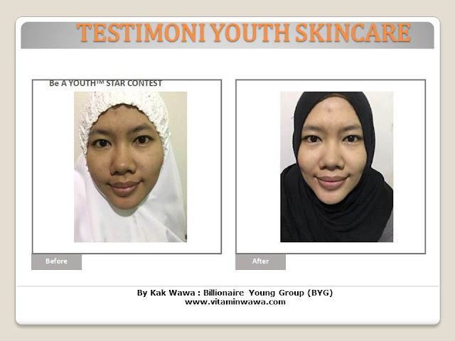 34 Testimoni Youth Skincare Shaklee Terbaru, Youth skincare shaklee, testimoni youth skincare shaklee, Youth Skincare Shaklee : Harga dan Review Pengguna Youth Shaklee, testimoni youth skincare shaklee, testimoni youth skincare shaklee