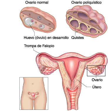 diferentes formas de quedar embarazada