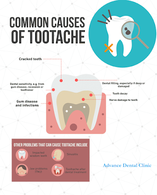 Toothache