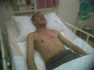 SharpShooter: Blogger Hijat terlantar di ICU Hospital Pantai