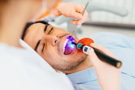 How Long Do Dental Sealants Last?