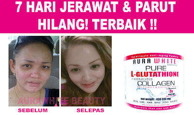 nak kulit cantik bersih bebas jerawat aurawhite dee wellness