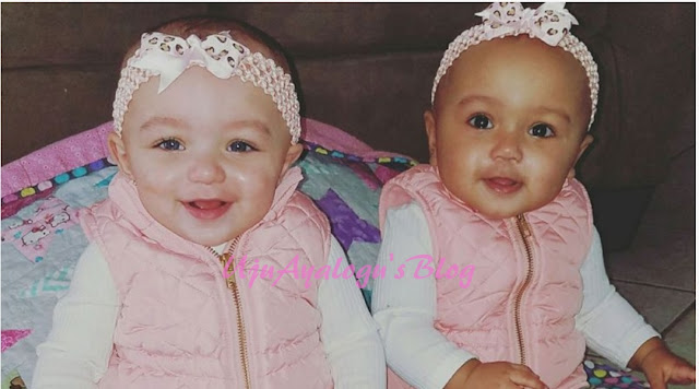 If your twins differ totally from each other, here’s why