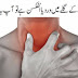 Medical Homeopathic And Home Remedies For Sore Throat