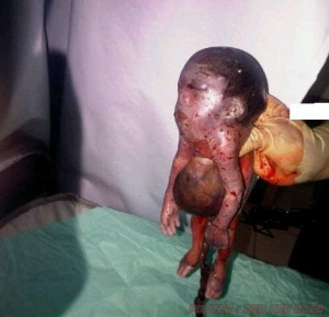 Gempar! Bayi Dengan Kaki Kambing Lahir di Nigeria
