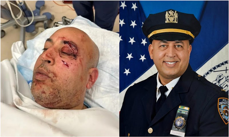 Detienen dos agresores de teniente dominicano del NYPD a quien dieron paliza en estación de trenes en El Bronx