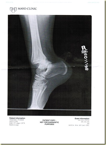 xray1