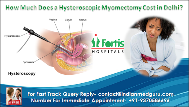 How Much Does a Hysteroscopic Myomectomy Cost in Delhi?