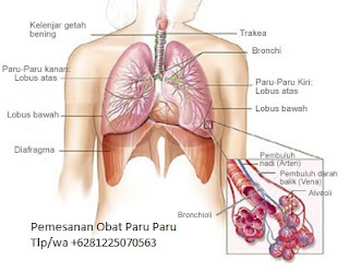 obat paru paru basah,obat flek Paru,Obat Tb Paru