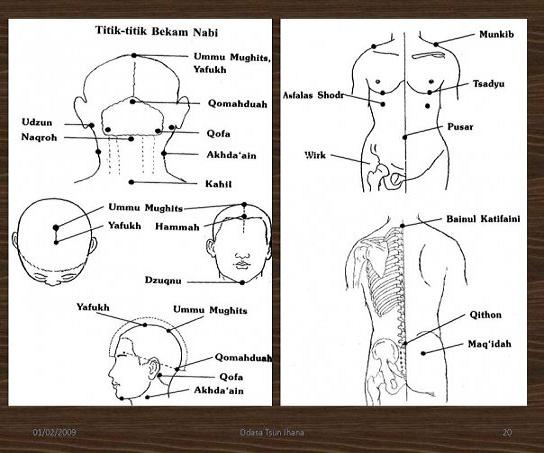  Gambar Titik  Bekam Nabi dan Khasiatnya