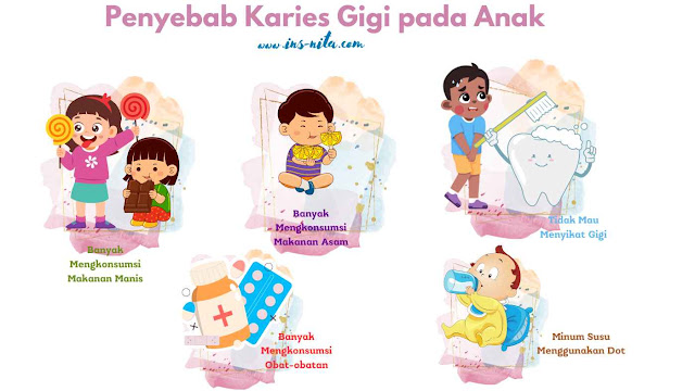 karies gigi anak