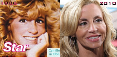 Camille Grammer Before After Plastic Surgery, Implants, Botox