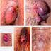 Obat Ambeclear Aman Untuk ibu Hamil thumbnail