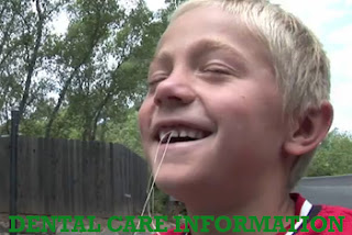 How to Pull Your Teeth