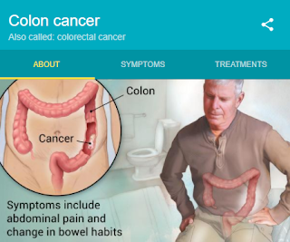 Colon Cancer: Polyps, The Main Precursors