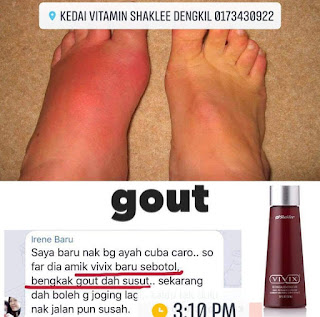 Vivix Untuk Gout