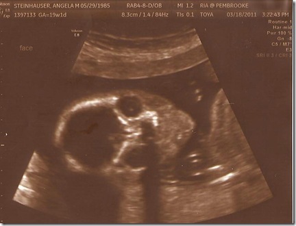 Baby #2(6)GIRL