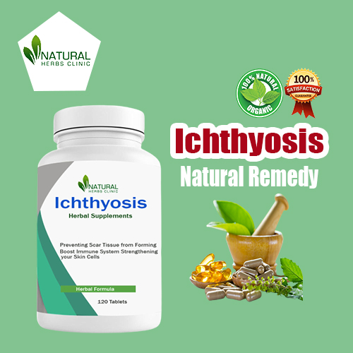 Healing Herbs for Ichthyosis