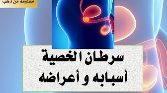 سرطان الخصيه أسبابه وأعراضه وطرق اكتشافه وعلاجه والوقاية منه