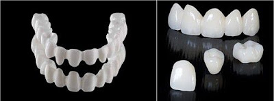  Ưu điểm của răng sứ Zirconia