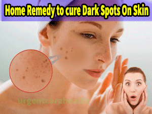 CURE DARK SPOTS ON SKIN SLUTION WITH HOME REMEDY 